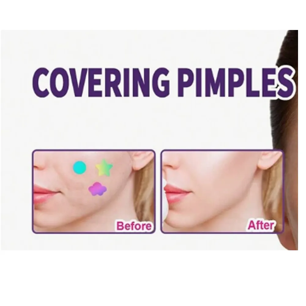 180-Piece Colorful Acne Pimple Concealer Patches