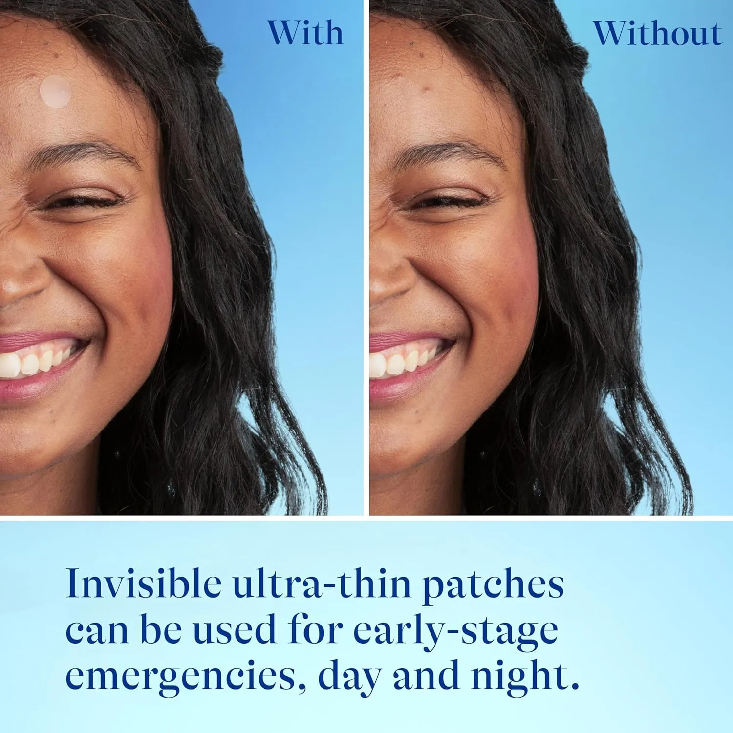 Acne - Prone Skin Patches