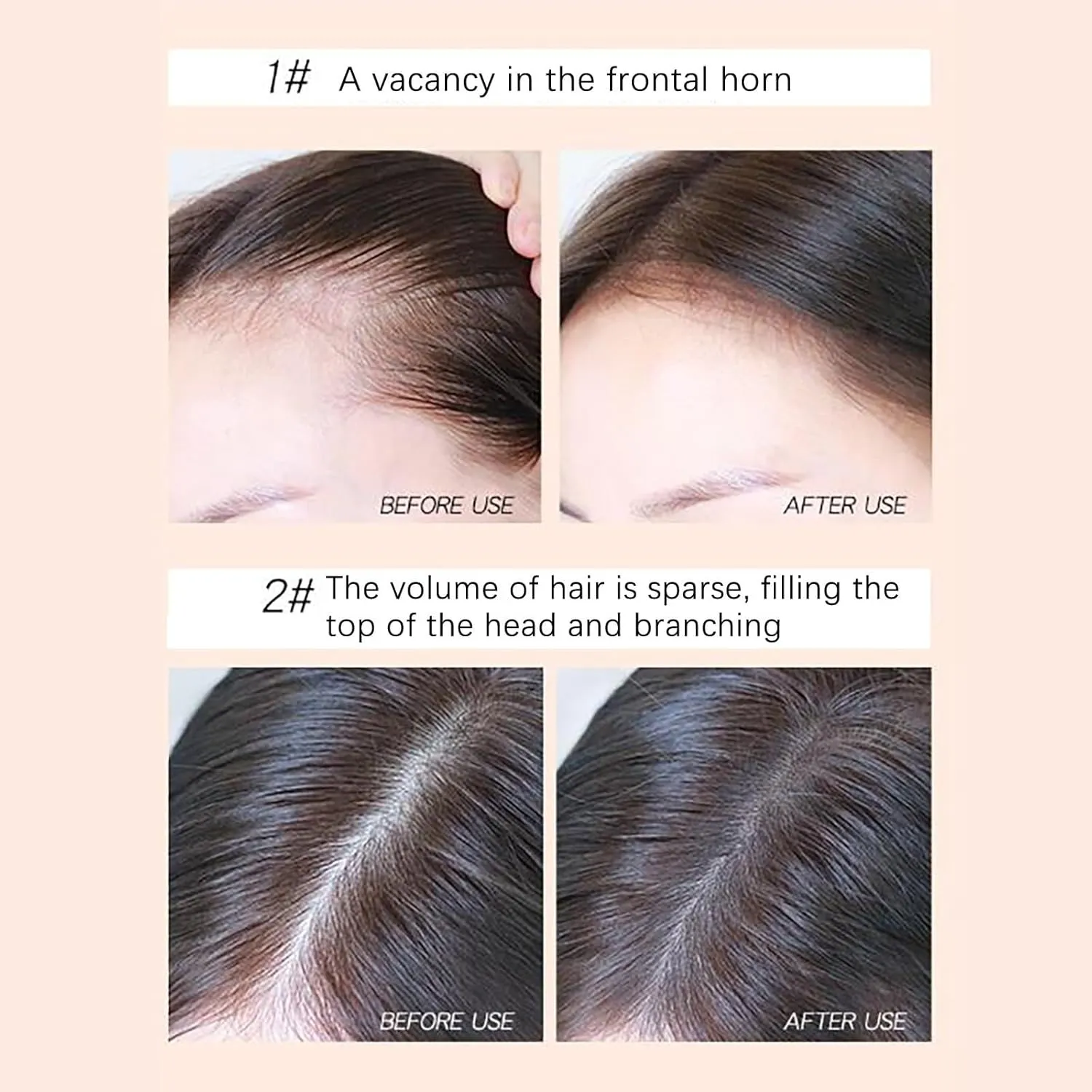 Root Modification Hairline Powder Powder Leave in Oil Control to Greasy Lazy Artifact Dry Hair Loose Powder Oil Control Home Perm (BW1, One Size)